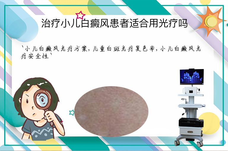 治疗小儿白癜风患者适合用光疗吗