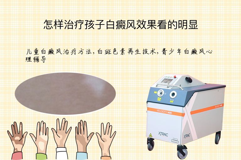 https://www.bdfsjzyy.com/d/file/p/928a4bacde732ee3ee1e284606903275.jpeg