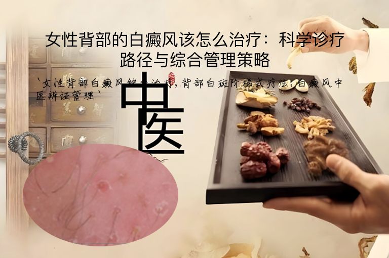 女性背部的白癜风该怎么治疗：科学诊疗路径与综合管理策略