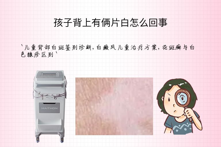 孩子背上有俩片白怎么回事