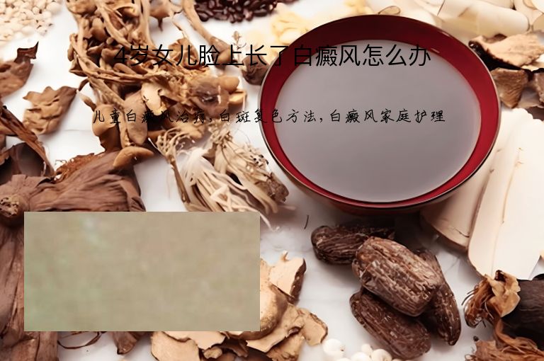4岁女儿脸上长了白癜风怎么办”