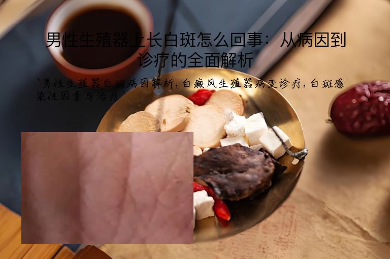 男性生殖器上长白斑怎么回事:从病因到诊疗的全面解析