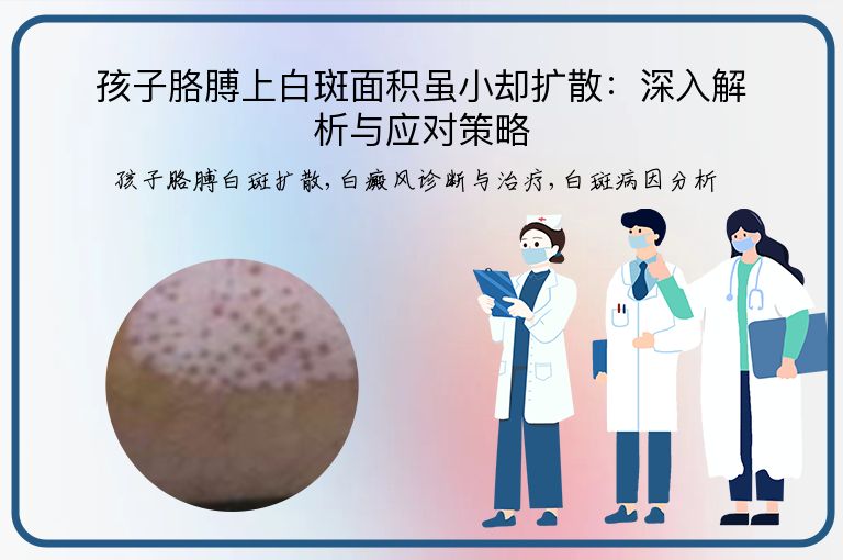 https://www.bdfsjzyy.com/d/file/p/3f9a5c760cdd21408b6b7dc3f4f3fb2c.jpeg