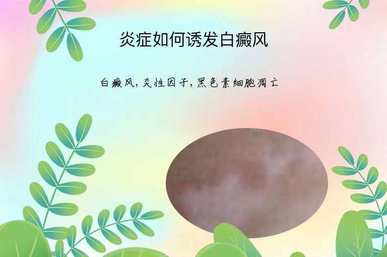 https://www.bdfsjzyy.com/d/file/p/f1cba6ac25fa92bcd4c2cc3fa8f78dea.jpeg