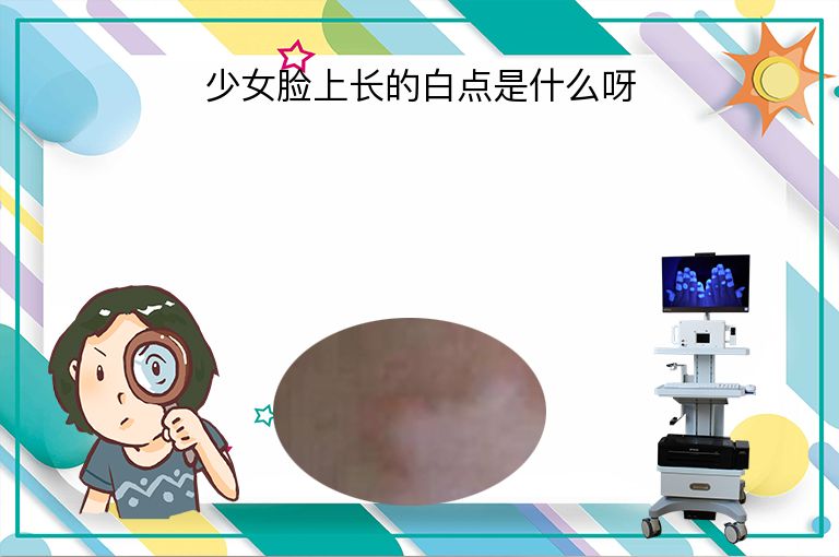少女脸上长的白点是什么呀”
