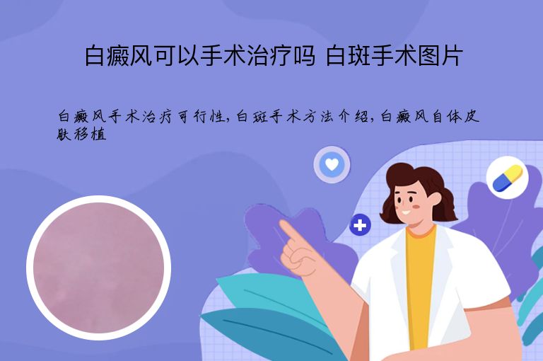 https://www.bdfsjzyy.com/d/file/p/41b99f7372eda59465ecb01849c95698.jpeg