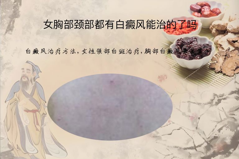 女胸部颈部都有白癜风能治的了吗”