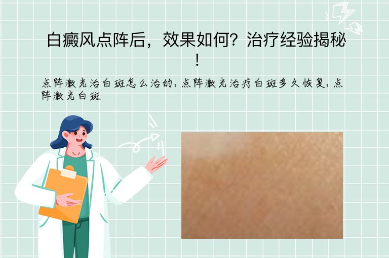 白癜风点阵后，效果如何？治疗经验揭秘！”