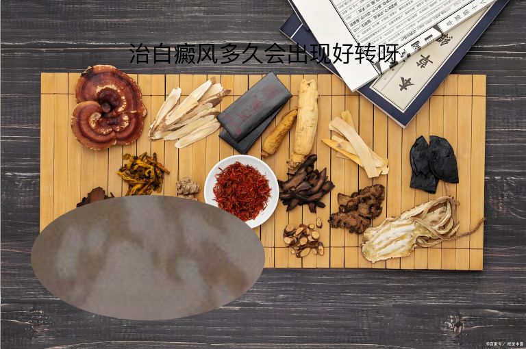 治白癜风多久会出现好转呀”