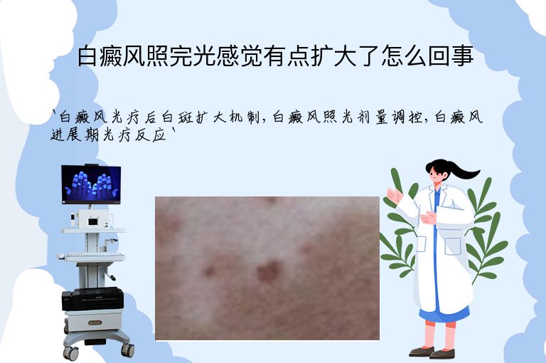 白癜风照完光感觉有点扩大了怎么回事”