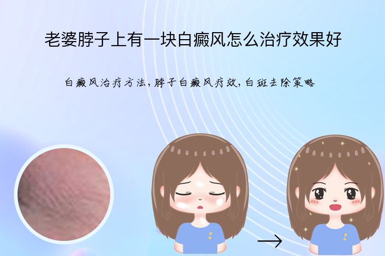 老婆脖子上有一块白癜风怎么治疗效果好”