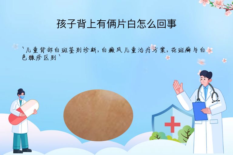 孩子背上有俩片白怎么回事