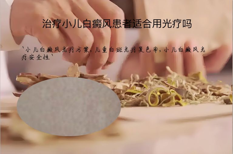 治疗小儿白癜风患者适合用光疗吗