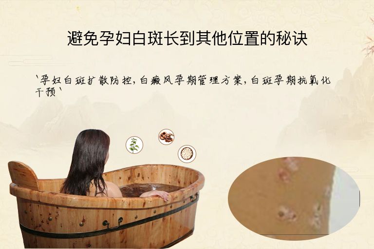避免孕妇白斑长到其他位置的秘诀