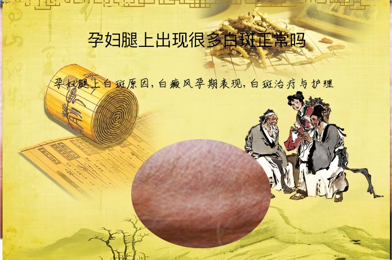 孕妇腿上出现很多白斑正常吗”