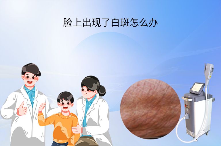 脸上出现了白斑怎么办”