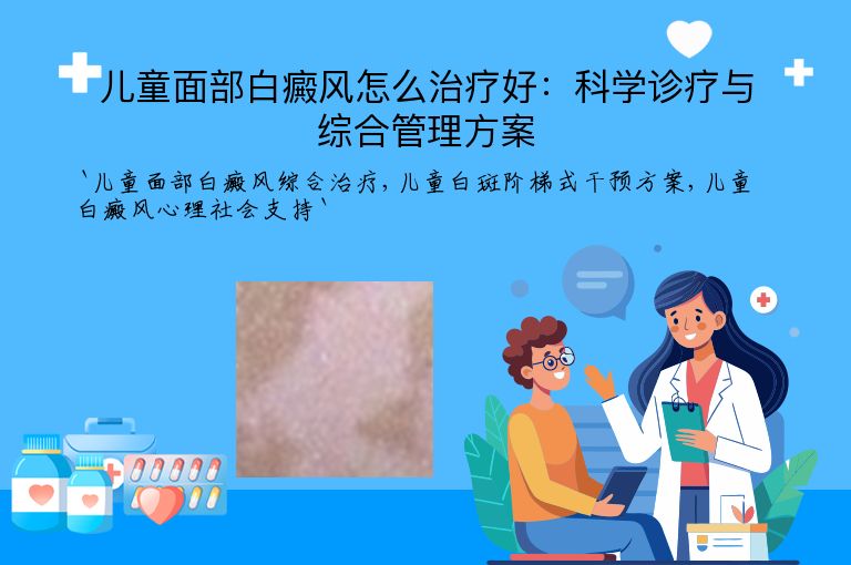 儿童面部白癜风怎么治疗好：科学诊疗与综合管理方案”