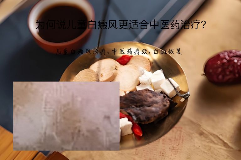 为何说儿童白癜风更适合中医药治疗?”