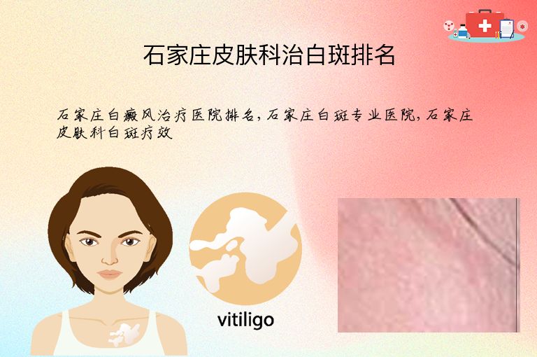 https://www.bdfsjzyy.com/d/file/p/3a4ef93d90389ccd29287849c2e69ac0.jpeg
