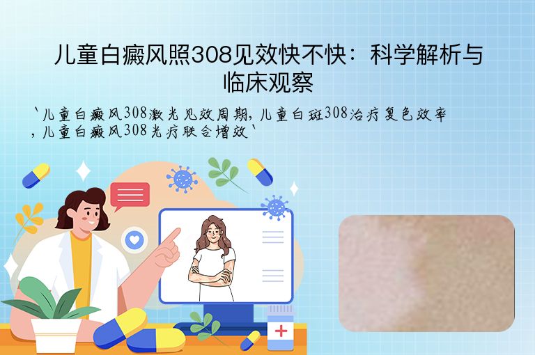 儿童白癜风照308见效快不快:科学解析与临床观察