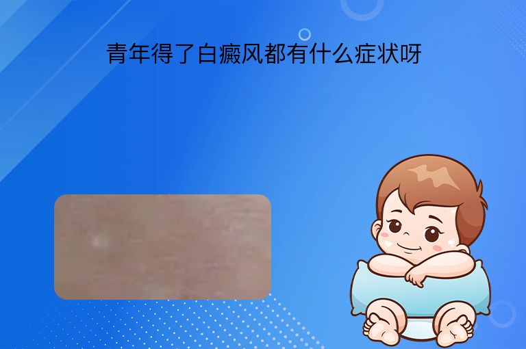 青年得了白癜风都有什么症状呀”