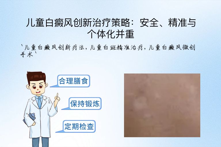 儿童白癜风创新治疗策略：安全、精准与个体化并重
