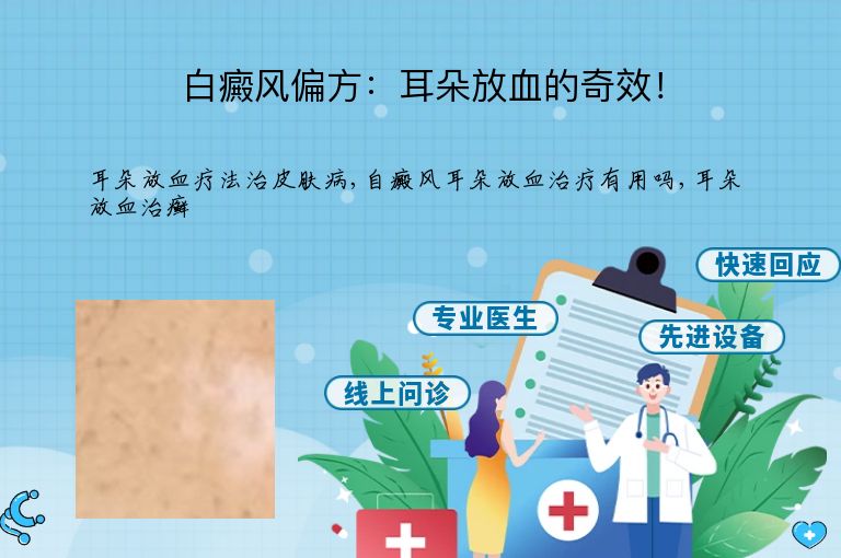 白癜风偏方:耳朵放血的奇效!”