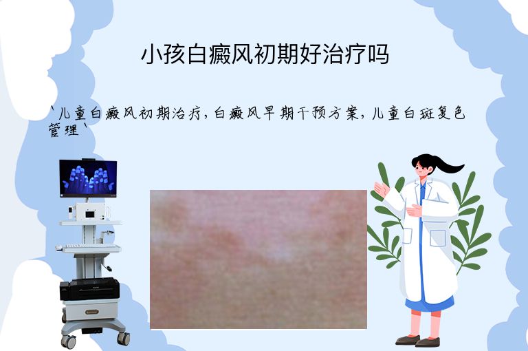 小孩白癜风初期好治疗吗