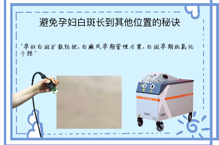 避免孕妇白斑长到其他位置的秘诀