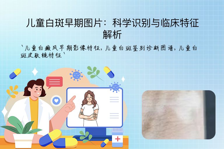 儿童白斑早期图片:科学识别与临床特征解析
