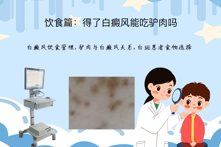 饮食篇：得了白癜风能吃驴肉吗”