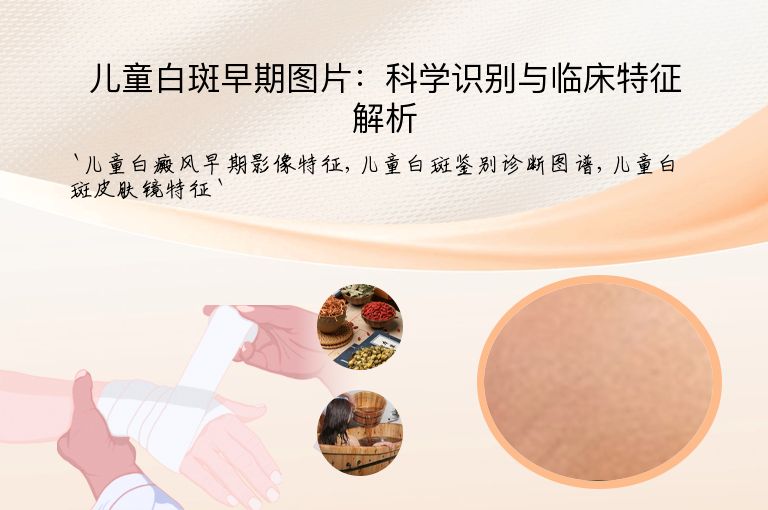 儿童白斑早期图片:科学识别与临床特征解析