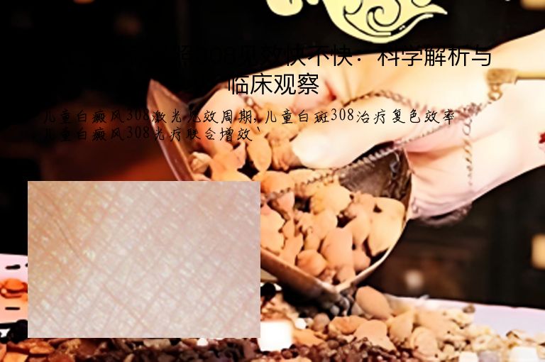 儿童白癜风照308见效快不快：科学解析与临床观察