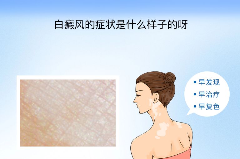 https://www.bdfsjzyy.com/d/file/p/70f890ecef7e1b1095888ffe1a25d29b.jpeg