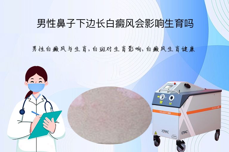男性鼻子下边长白癜风会影响生育吗”