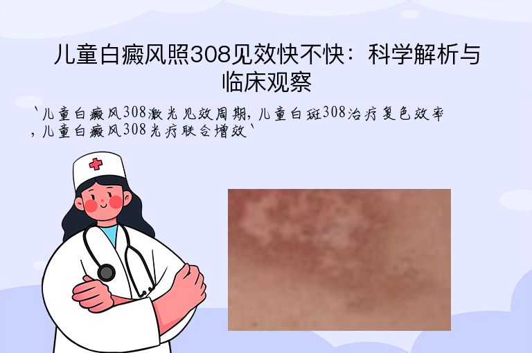 儿童白癜风照308见效快不快:科学解析与临床观察
