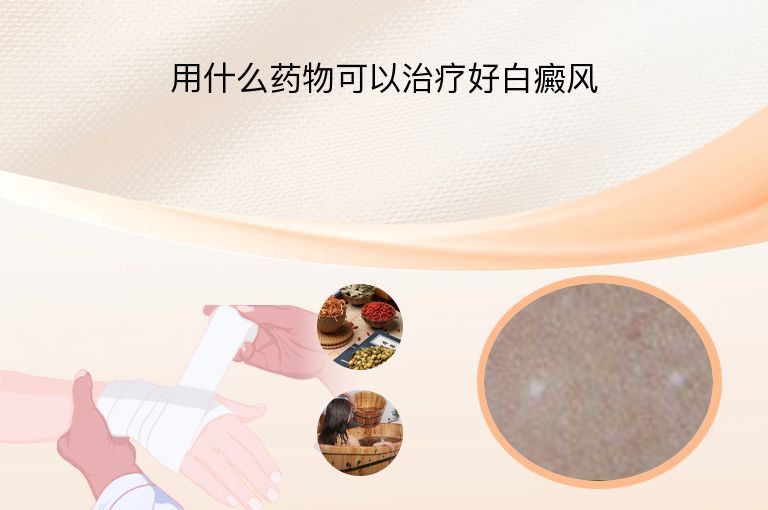 用什么药物可以治疗好白癜风”