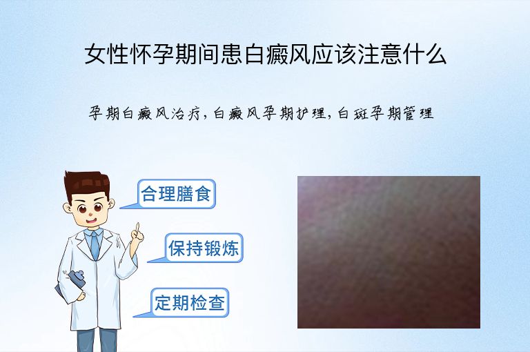 女性怀孕期间患白癜风应该注意什么”