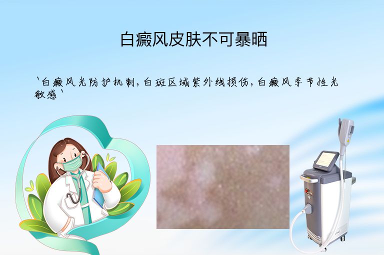 白癜风皮肤不可暴晒