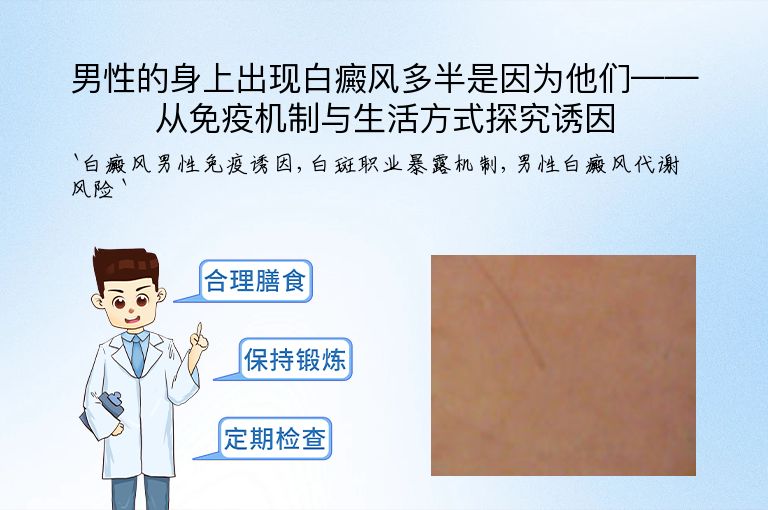男性的身上出现白癜风多半是因为他们——从免疫机制与生活方式探究诱因
