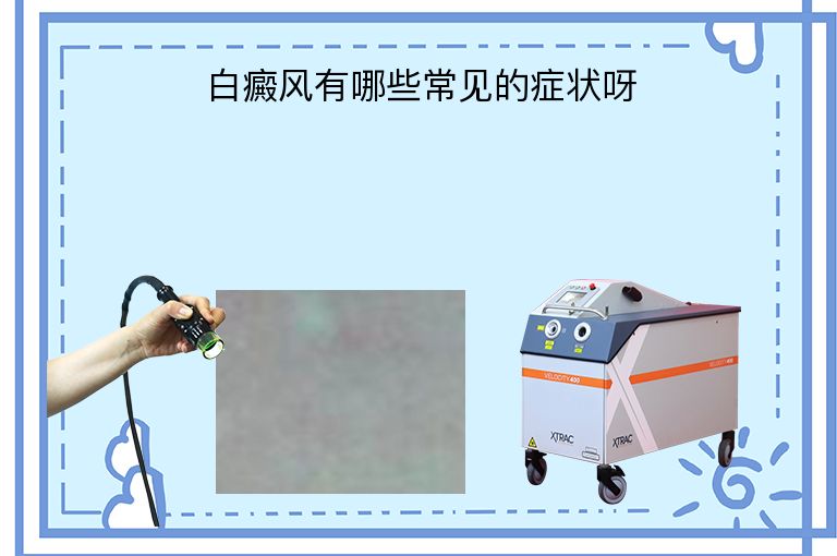 https://www.bdfsjzyy.com/d/file/p/597bf6853554e30bfb9fff34ba3a0740.jpeg