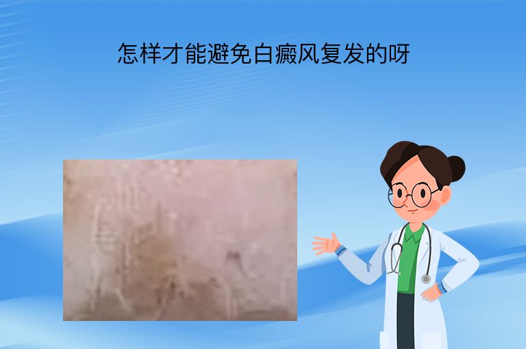 怎样才能避免白癜风复发的呀”