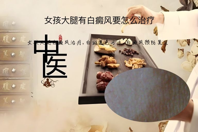 女孩大腿有白癜风要怎么治疗”