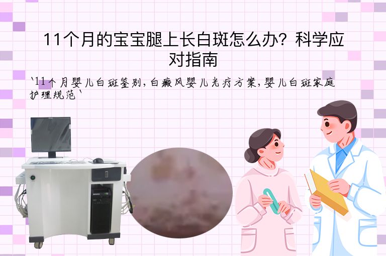 11个月的宝宝腿上长白斑怎么办？科学应对指南”