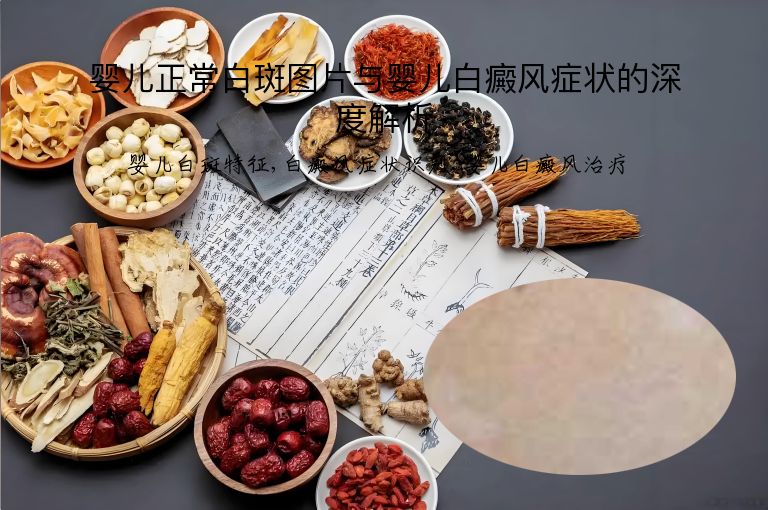 婴儿正常白斑图片与婴儿白癜风症状的深度解析”