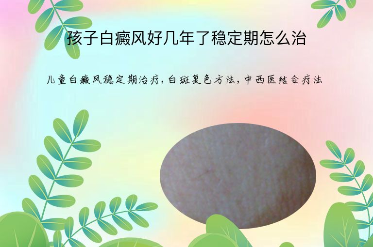 孩子白癜风好几年了稳定期怎么治”