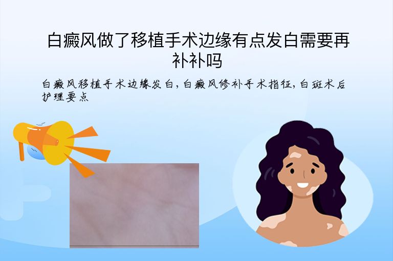白癜风做了移植手术边缘有点发白需要再补补吗”