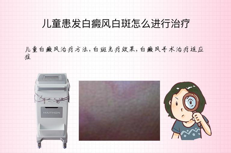 儿童患发白癜风白斑怎么进行治疗”