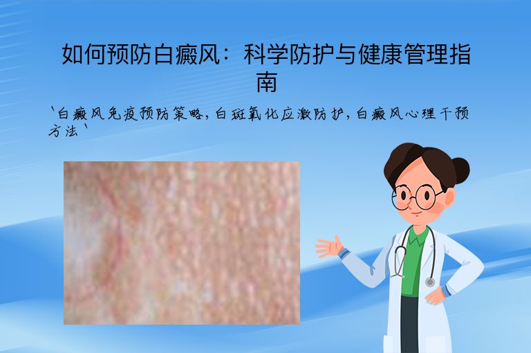 如何预防白癜风：科学防护与健康管理指南