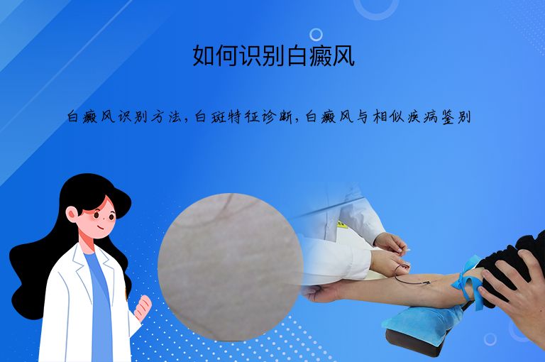 如何识别白癜风”
